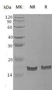 Human CST1 (His tag) recombinant protein