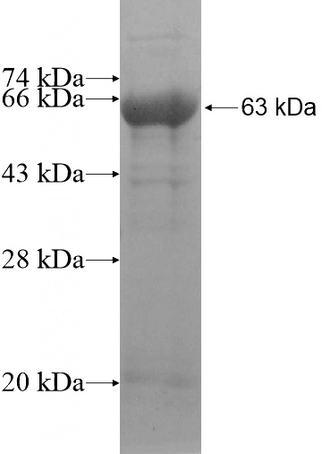 Recombinant Human C11orf49 SDS-PAGE