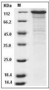 Human VE-Cadherin / CD144 / CDH5 Protein (His & Fc Tag) SDS-PAGE