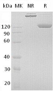 Human PIGR (Fc tag) recombinant protein