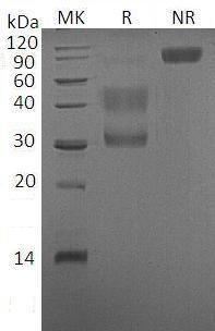 Human MET (His tag) recombinant protein