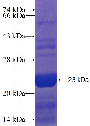 Recombinant Human AP1S2 SDS-PAGE