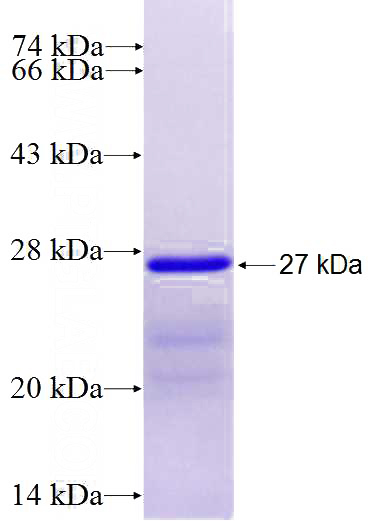 Recombinant Human GPC2 SDS-PAGE
