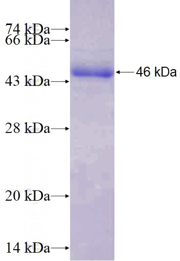 Recombinant Human HDAC5 SDS-PAGE