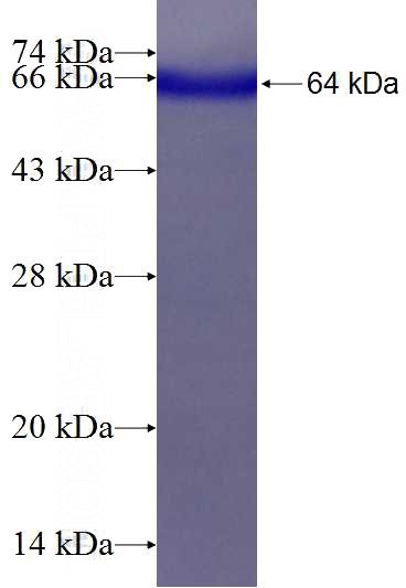 Recombinant Human RNF2 SDS-PAGE