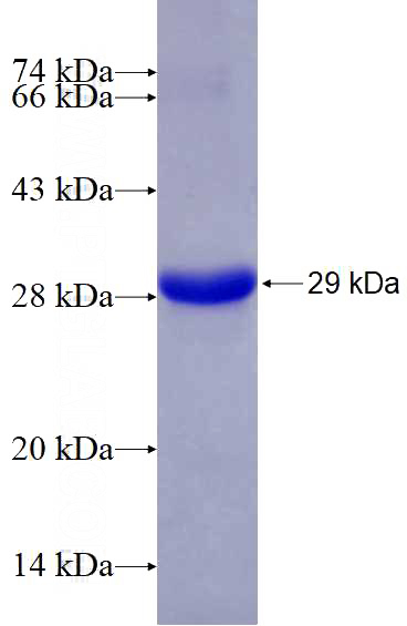 Recombinant Human BCR SDS-PAGE