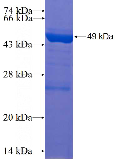 Recombinant Human RRAS2 SDS-PAGE