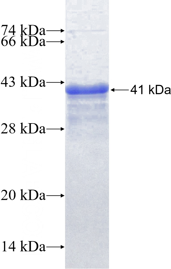 Recombinant Human RGC32 SDS-PAGE