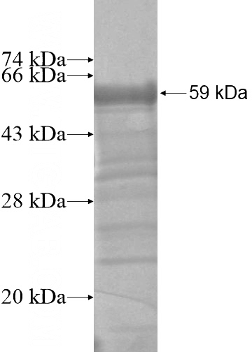 Recombinant Human MAP7D1 SDS-PAGE
