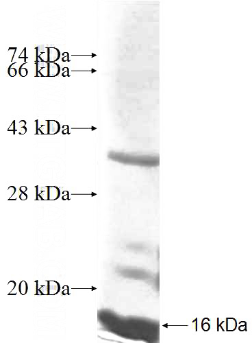 Recombinant Human CKS2 SDS-PAGE