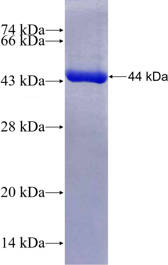 Recombinant Human ARL5B SDS-PAGE