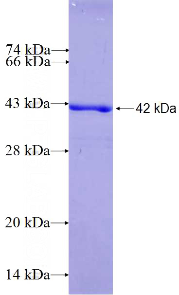 Recombinant Human CIDEB SDS-PAGE