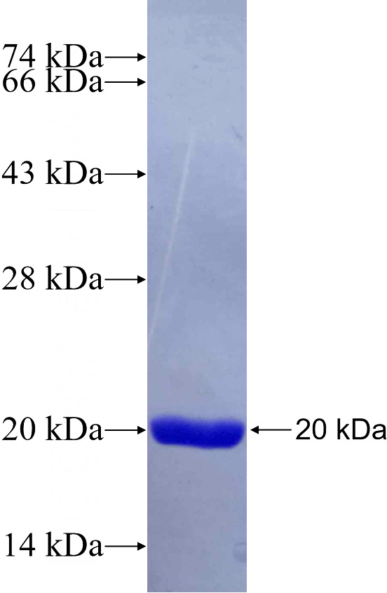 Recombinant Human ARMC3 SDS-PAGE