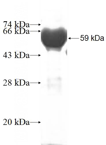 Recombinant Human PPA1 SDS-PAGE