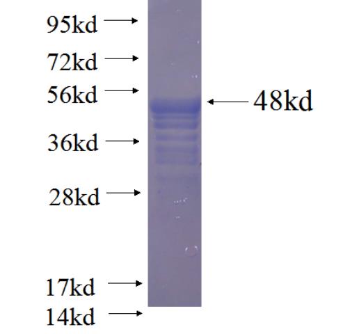 Recombinant human MYL3 SDS-PAGE