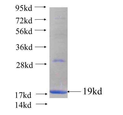 Recombinant human JMJD1C SDS-PAGE