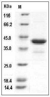 Human PCBP1 Protein (His Tag) SDS-PAGE
