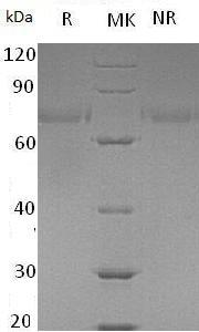 Human LRRTM2/KIAA0416/LRRN2 (His tag) recombinant protein