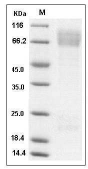 Mouse ADAM15 / MDC15 Protein (His Tag) SDS-PAGE