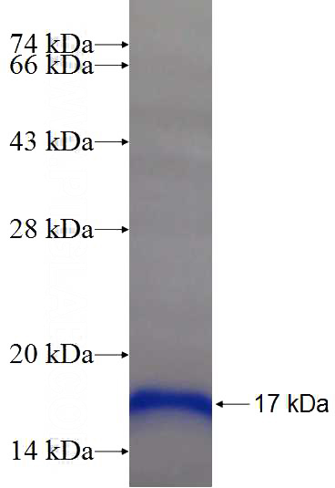 Recombinant Human WWC2 SDS-PAGE