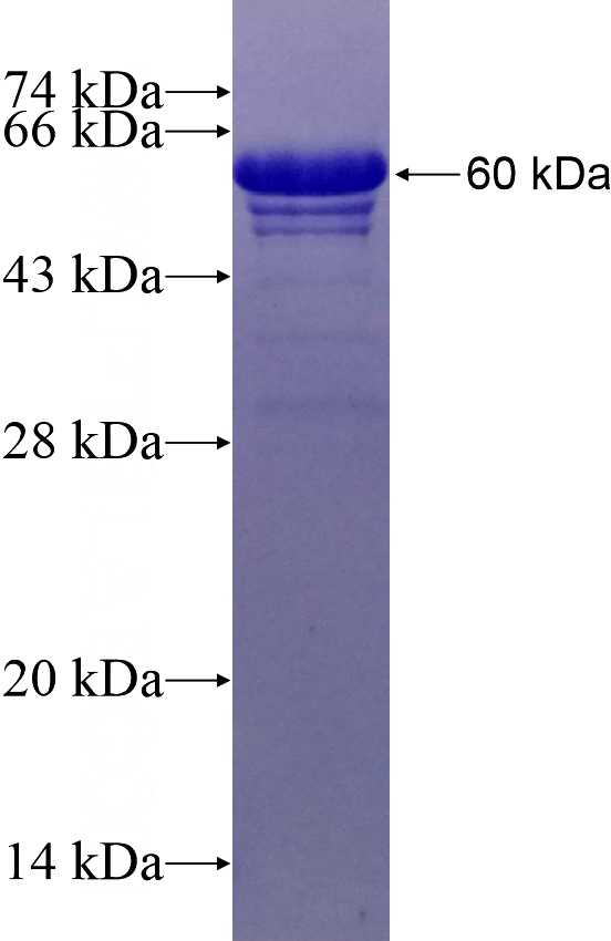Recombinant Human SDC4 SDS-PAGE