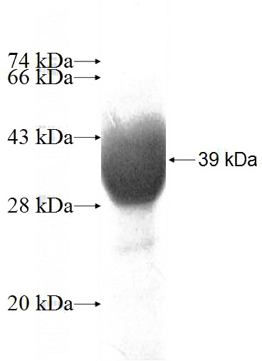 Recombinant Human PKD1L2 SDS-PAGE