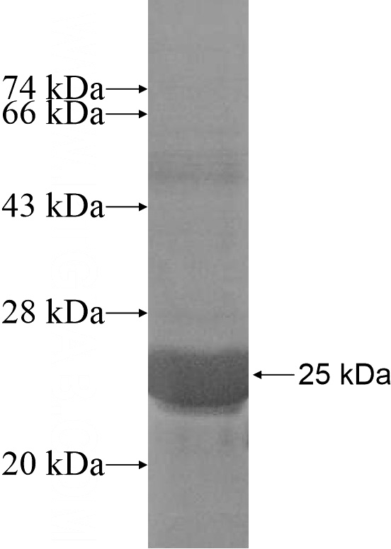 Recombinant Human MOGAT2 SDS-PAGE