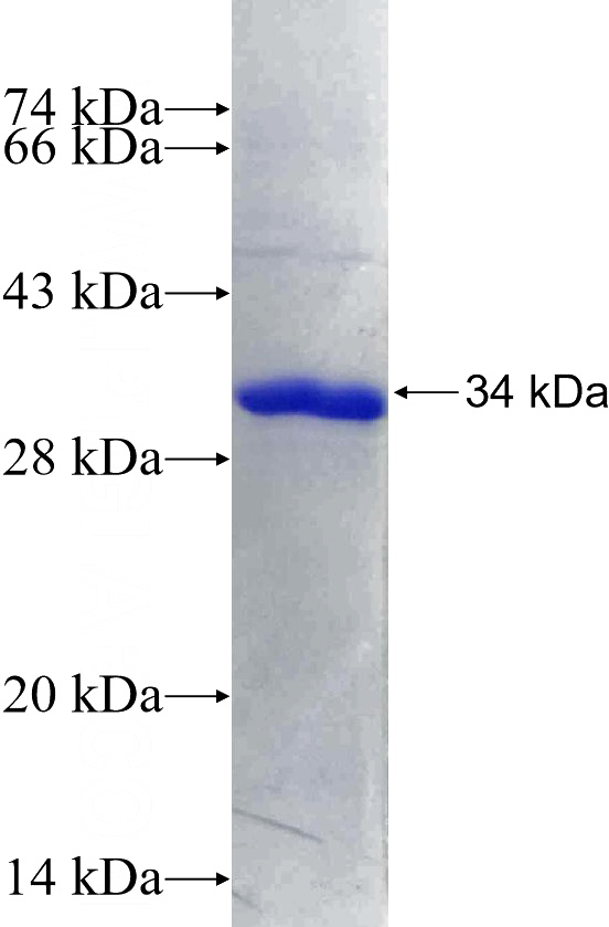 Recombinant Human SDHB SDS-PAGE