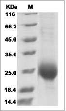 Cynomolgus ALK-1 / ACVRL1 Protein (His Tag)