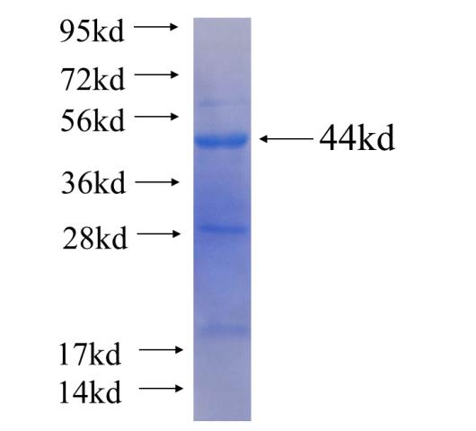 Recombinant human RAG2 SDS-PAGE