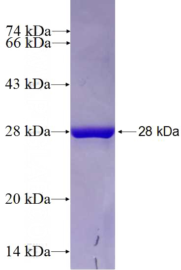 Recombinant Human SPC24 SDS-PAGE
