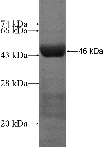 Recombinant Human CENPM SDS-PAGE