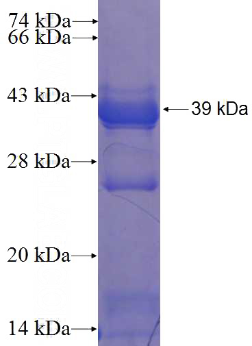 Recombinant Human API5 SDS-PAGE