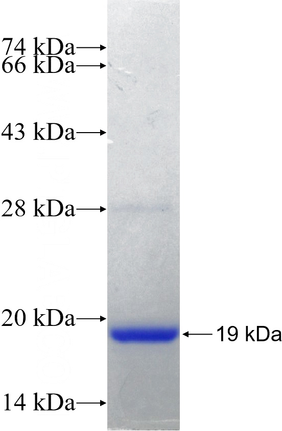 Recombinant Human RABIF SDS-PAGE