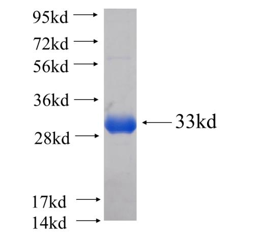 Recombinant human PCDHGB3 SDS-PAGE