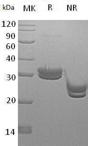 Human KLK7/PRSS6/SCCE (His tag) recombinant protein