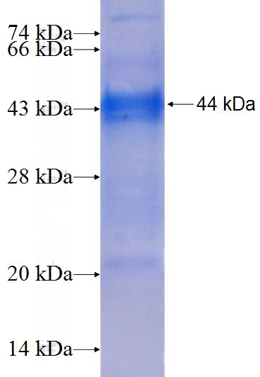 Recombinant Human P4HTM SDS-PAGE