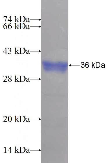 Recombinant Human TBC1D23 SDS-PAGE