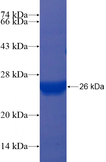 Recombinant Human ARL4C SDS-PAGE