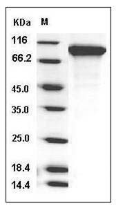 Human Neuroligin 1 / NLGN1 Protein (His Tag) SDS-PAGE