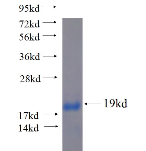 Recombinant human HBG1 SDS-PAGE