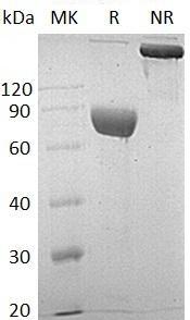 Human LRG1/LRG (Fc & His tag) recombinant protein
