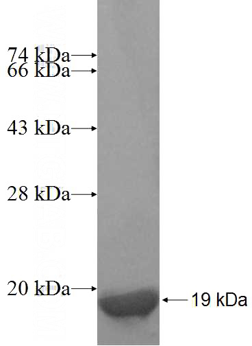 Recombinant Human ARIP2; SYNJ2BP SDS-PAGE