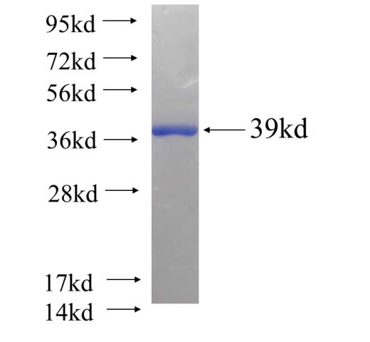 Recombinant human GLOD4(Full length) SDS-PAGE