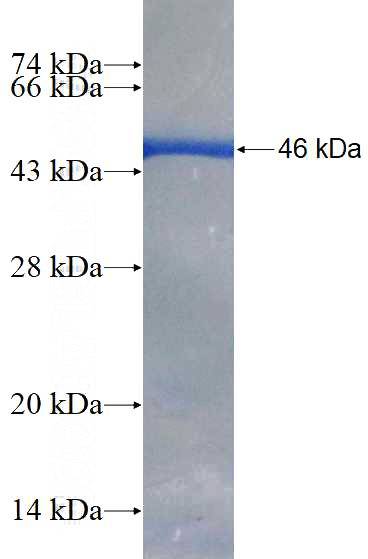 Recombinant Human ARL8B SDS-PAGE