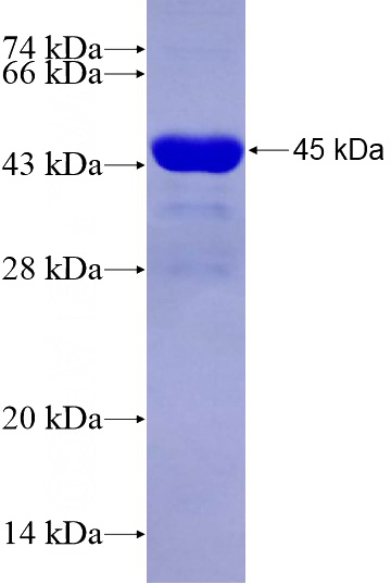 Recombinant Human CKAP5 SDS-PAGE
