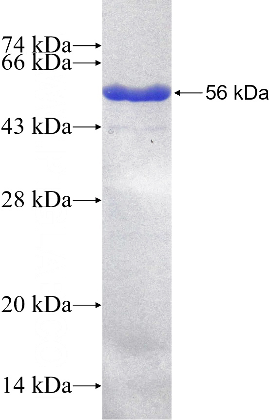 Recombinant Human CCDC171 SDS-PAGE
