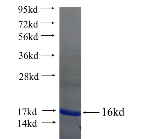 Recombinant human C6orf173 SDS-PAGE