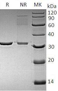 Human VSNL1/VISL1 (His tag) recombinant protein