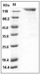 Human CEACAM5 / CD66e Protein (His & Fc Tag) SDS-PAGE
